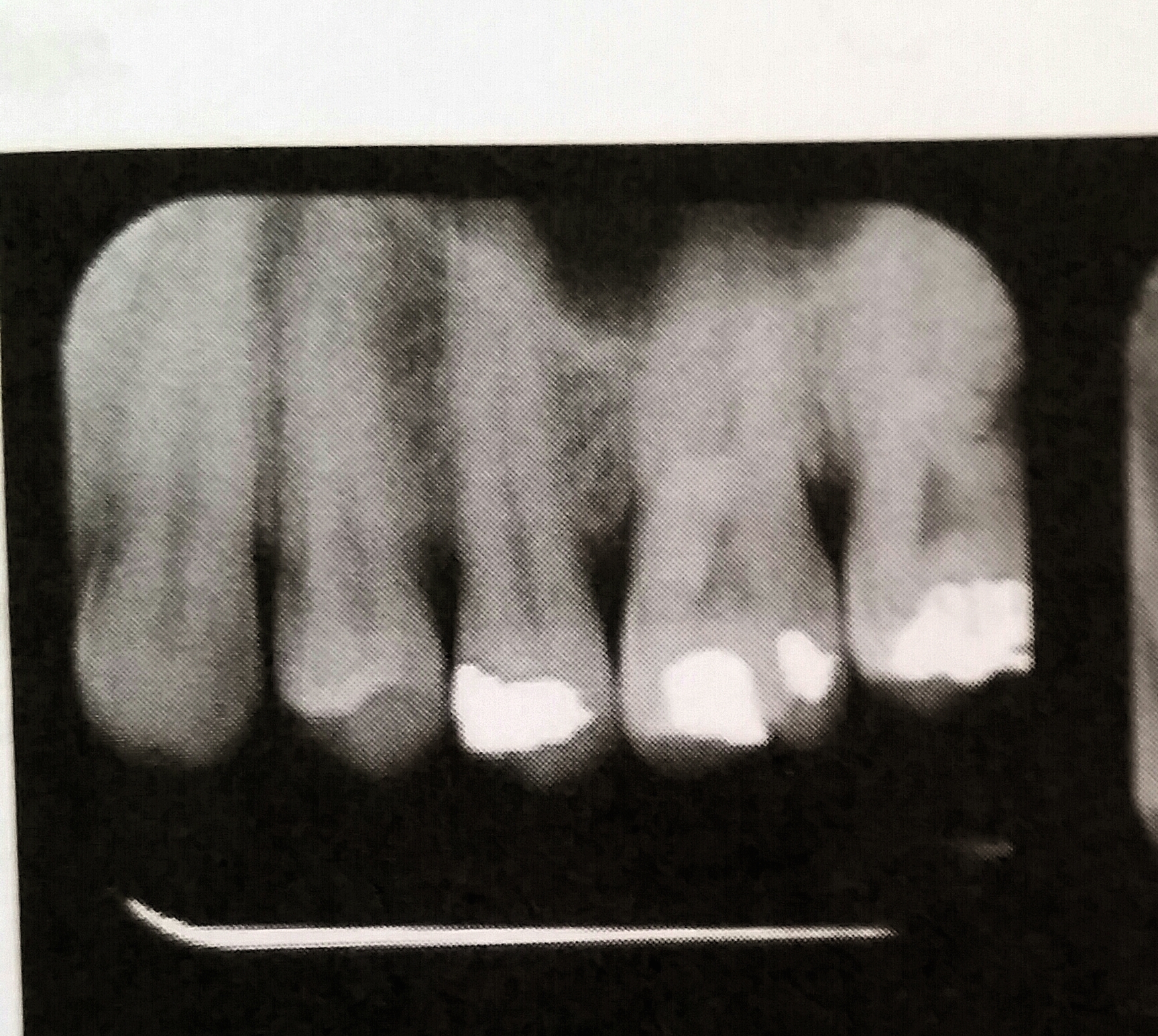 Quia RADIOGRAPHY TSA