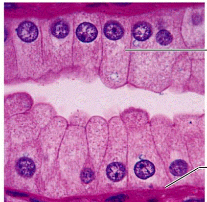 Quia - KM Anatomy - Histology - Tissue Images ... stratified cuboidal diagram 