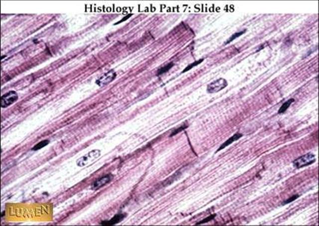 Quia - Tissues Identification Matchup mammal of the kidney diagram 