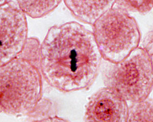 Metaphase In Animal Cell