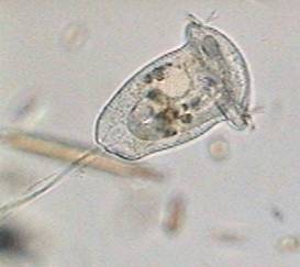 Quia - Protozoa brain diagram labeled 